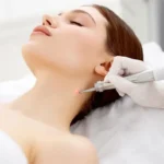 خالبرداری و برداشتن ضایعات پوستی در صدرا